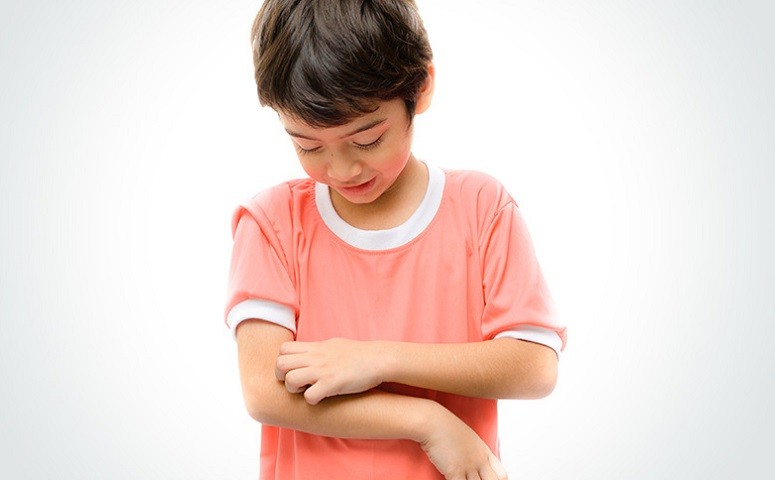 How To Detect And Treat The Symptoms Of Ringworm In Children