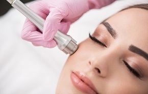 Microdermabrasion for Smaller Scars